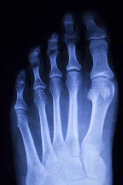Mano dedos pulgar muñeca rayos X escanear — Foto de Stock
