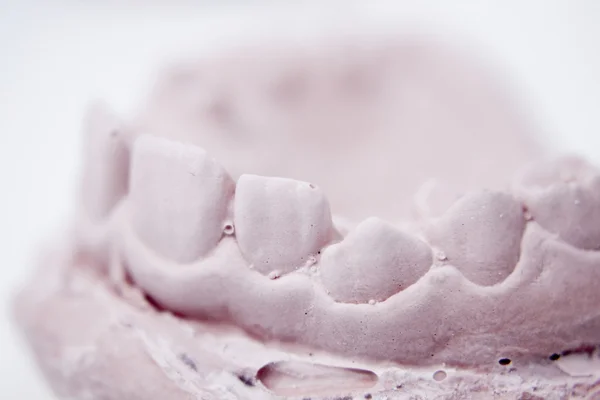 Зубной протез глиняная форма зуба — стоковое фото