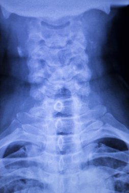 Kafatası boyun omurga omuz xray inceden inceye gözden geçirmek