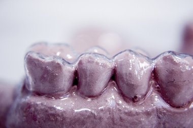 Dental prosthetics clay tooth mold clipart