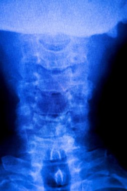 Kafatası boyun omurga omuz xray inceden inceye gözden geçirmek