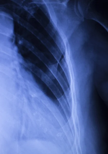 Рентген спины позвоночника — стоковое фото
