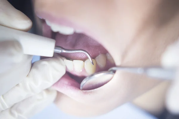 Dentista paciente boca examen dental — Foto de Stock