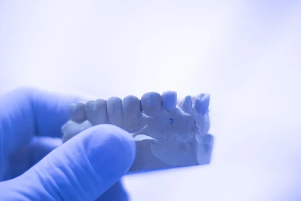 Dentist's dental tooth mold — Stock Photo, Image