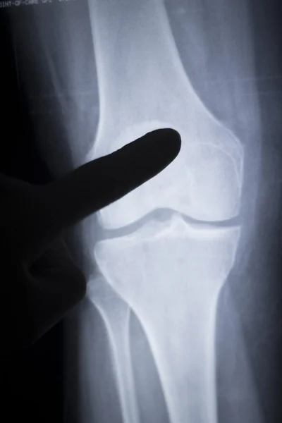 Knee injury surgeon xray scan