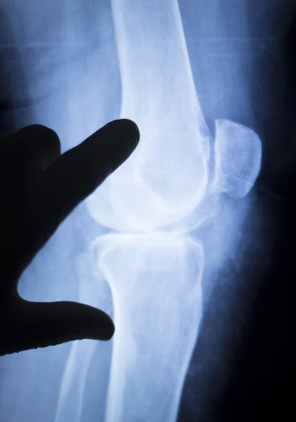 Knee injury surgeon xray scan