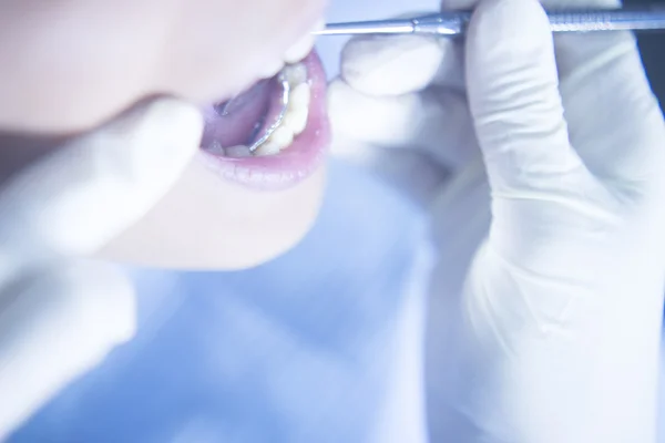 Dentist patient mouth dental exam — Stock Photo, Image