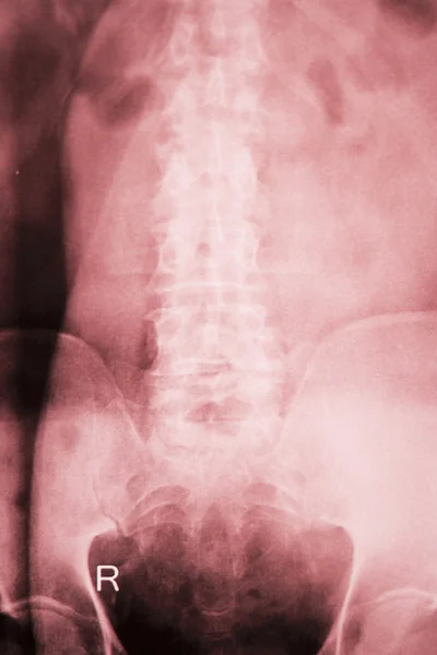 Хирургическое сканирование тазобедренного сустава — стоковое фото