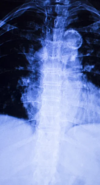 Рентген шеи позвоночника — стоковое фото