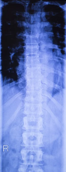 목과 척추 부상 엑스레이 검사 — 스톡 사진