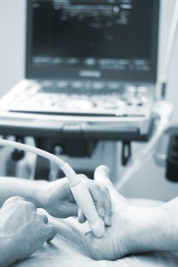 Epi perkütan intratissue elektroliz