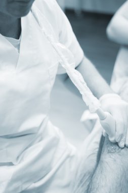 Epi perkütan intratissue elektroliz