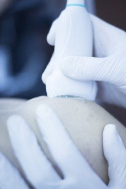 Epi perkütan intratissue elektroliz