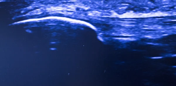Ультразвуковая экография EPI — стоковое фото