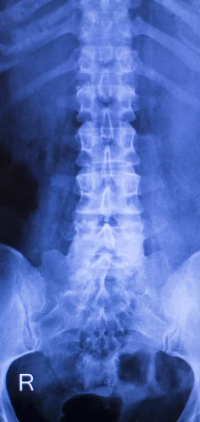 Neck and spine injury xray scan — Stock Photo, Image