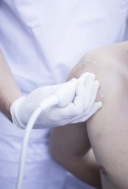 Epi perkütan intratissue elektroliz