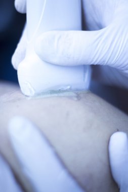 Epi perkütan intratissue elektroliz