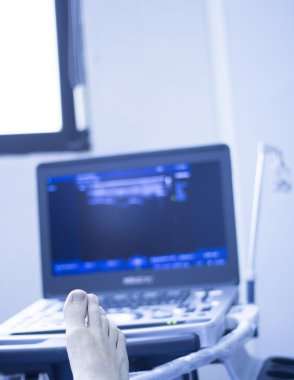 Epi perkütan intratissue elektroliz