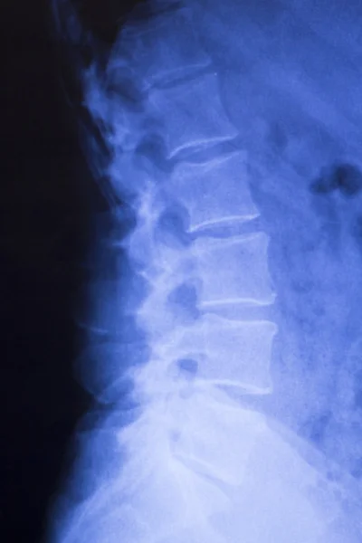 Рентген шеи и позвоночника — стоковое фото
