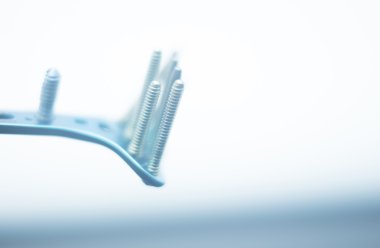 Ortopedik cerrahi plaka ve vida implant