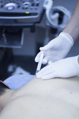  Intratissue perkütan elektroliz Epi