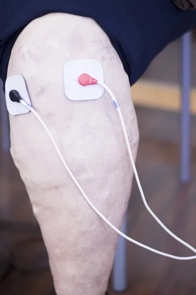 Fisioterapia de estimulación de electrodos — Foto de Stock