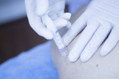  Intratissue perkütan elektroliz Epi