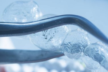 Modern görünmez parantez hizalayıcıları dişçiler tarafından dişlerin hizalanmasını düzeltmek için kullanılır.