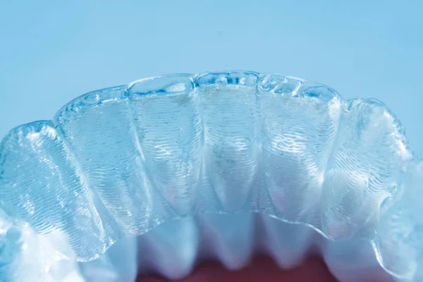 Сучасні Невидимі Дужки Інопланетні Випрямлячі Які Використовуються Виправлення Вирівнювання Зубів — стокове фото