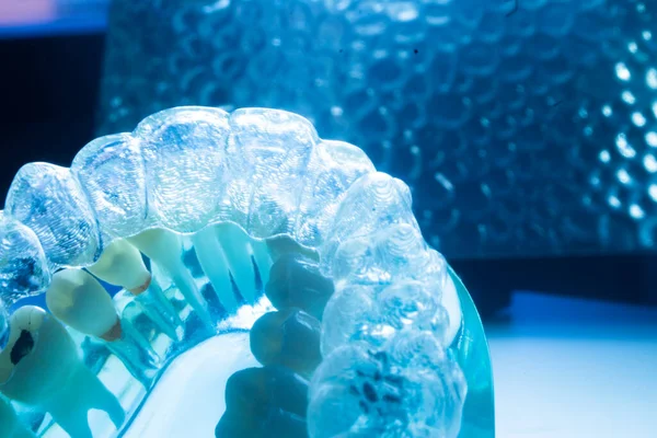 Modern Görünmez Parantez Hizalayıcıları Dişçiler Tarafından Dişlerin Hizalanmasını Düzeltmek Için — Stok fotoğraf