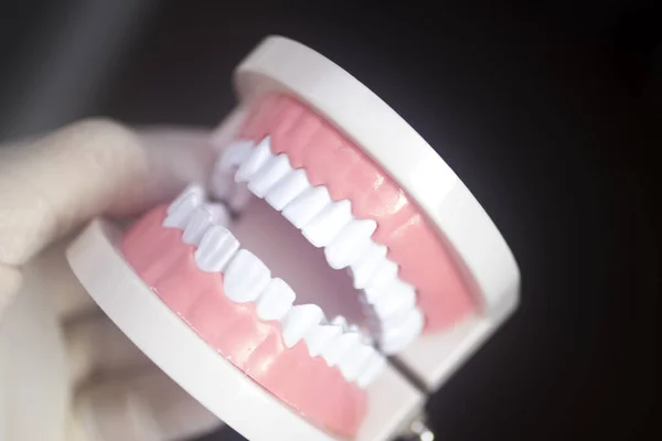 Dentistas Dientes Blancos Modelo Odontología Primer Plano — Foto de Stock