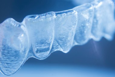 Modern görünmez parantez hizalayıcıları dişçiler tarafından dişlerin hizalanmasını düzeltmek için kullanılır.