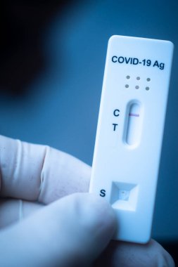 Covid 19 virüs salgını test sonuçları evde salya çıkmadı..
