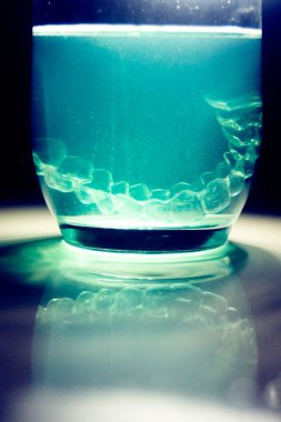 Modern görünmez parantez hizalayıcıları dişçiler tarafından dişlerin hizalanmasını düzeltmek için kullanılır.