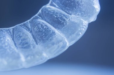 Modern görünmez parantez hizalayıcıları dişçiler tarafından dişlerin hizalanmasını düzeltmek için kullanılır.