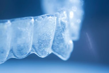 Modern görünmez parantez hizalayıcıları dişçiler tarafından dişlerin hizalanmasını düzeltmek için kullanılır.