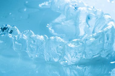 Modern görünmez parantez hizalayıcıları dişçiler tarafından dişlerin hizalanmasını düzeltmek için kullanılır.