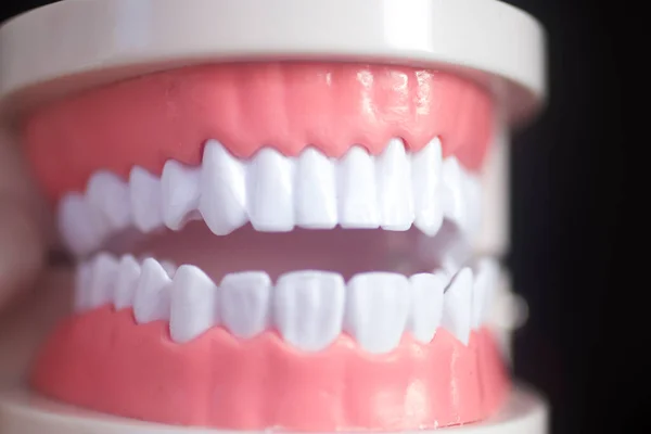 Dentists White Teeth Dentistry Model Closeup — Stock Photo, Image