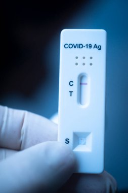 Covid 19 virüs salgını test sonuçları evde salya çıkmadı..