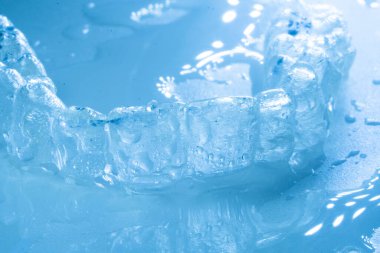 Modern görünmez parantez hizalayıcıları dişçiler tarafından dişlerin hizalanmasını düzeltmek için kullanılır.