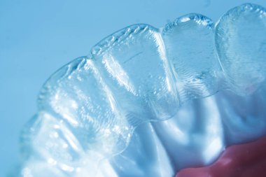 Modern görünmez parantez hizalayıcıları dişçiler tarafından dişlerin hizalanmasını düzeltmek için kullanılır.