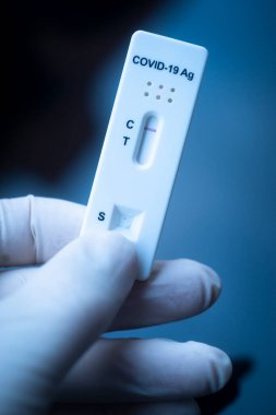Covid 19 virüs salgını test sonuçları evde salya çıkmadı..