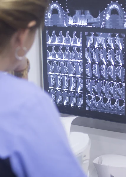 Dental xray scan on viewer in dentist clinic — Stock Photo, Image