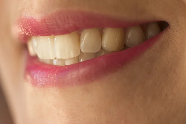 Macro de sonrisa femenina con dientes y lápiz labial rosa — Foto de Stock