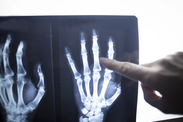 Medical doctor pointing at radiograph x-ray image — Stock Photo, Image
