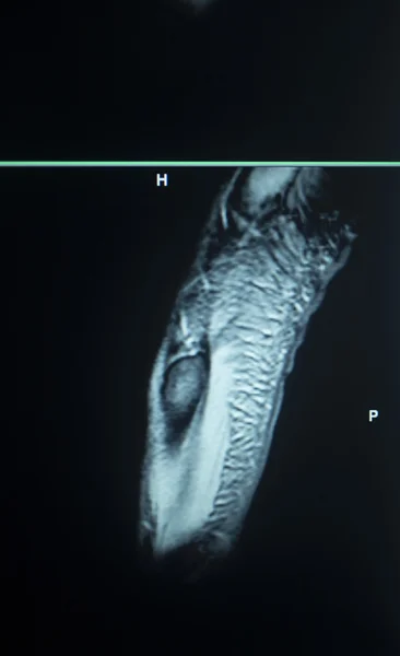 Результати МРТ-тестування пошкодження ніг — стокове фото