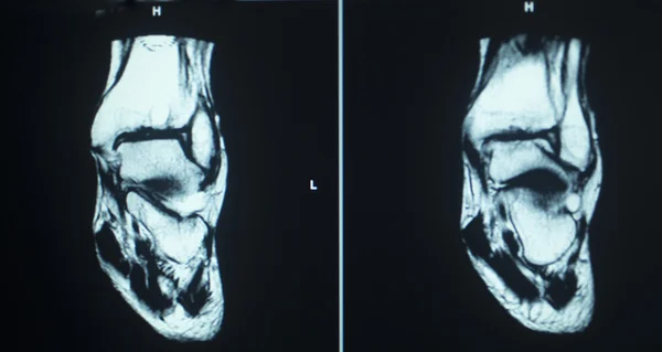 Mri スキャン テスト結果怪我 ストックフォト