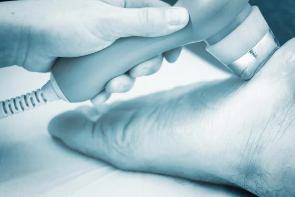 Musclefoot poranění kmene bolesti rehabilitační léčba — Stock fotografie