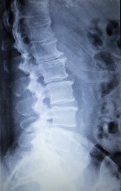 X-ray orthopedics Traumatology scan back pain spine injury clipart
