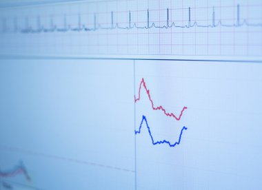 Spor performans fitness dayanıklılık değerlendirme testi gaz analysi